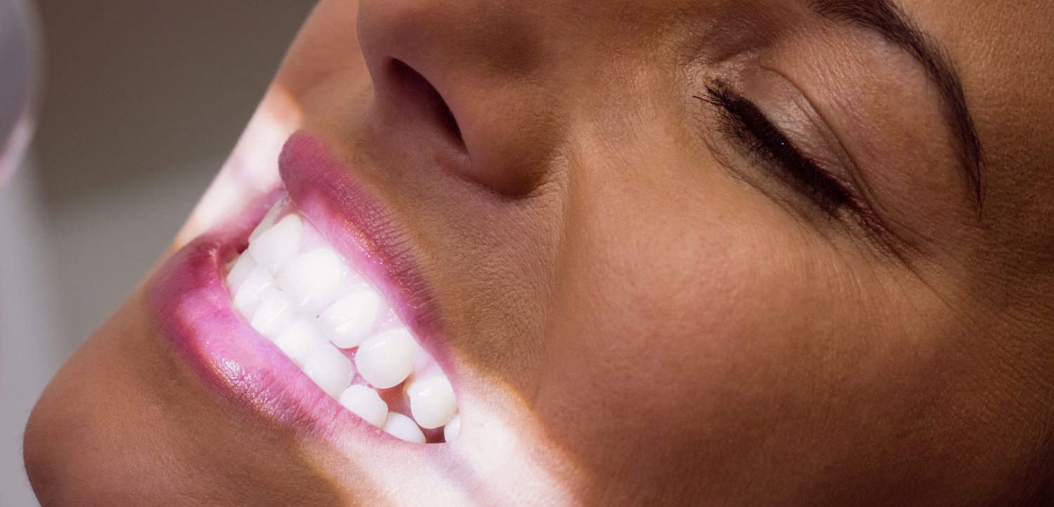 Jak długo utrzymują się efekty wybielania zębów